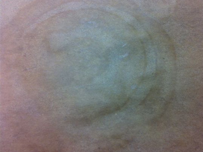 �n���� - �낤�т����͔M���ŗn���܂��B